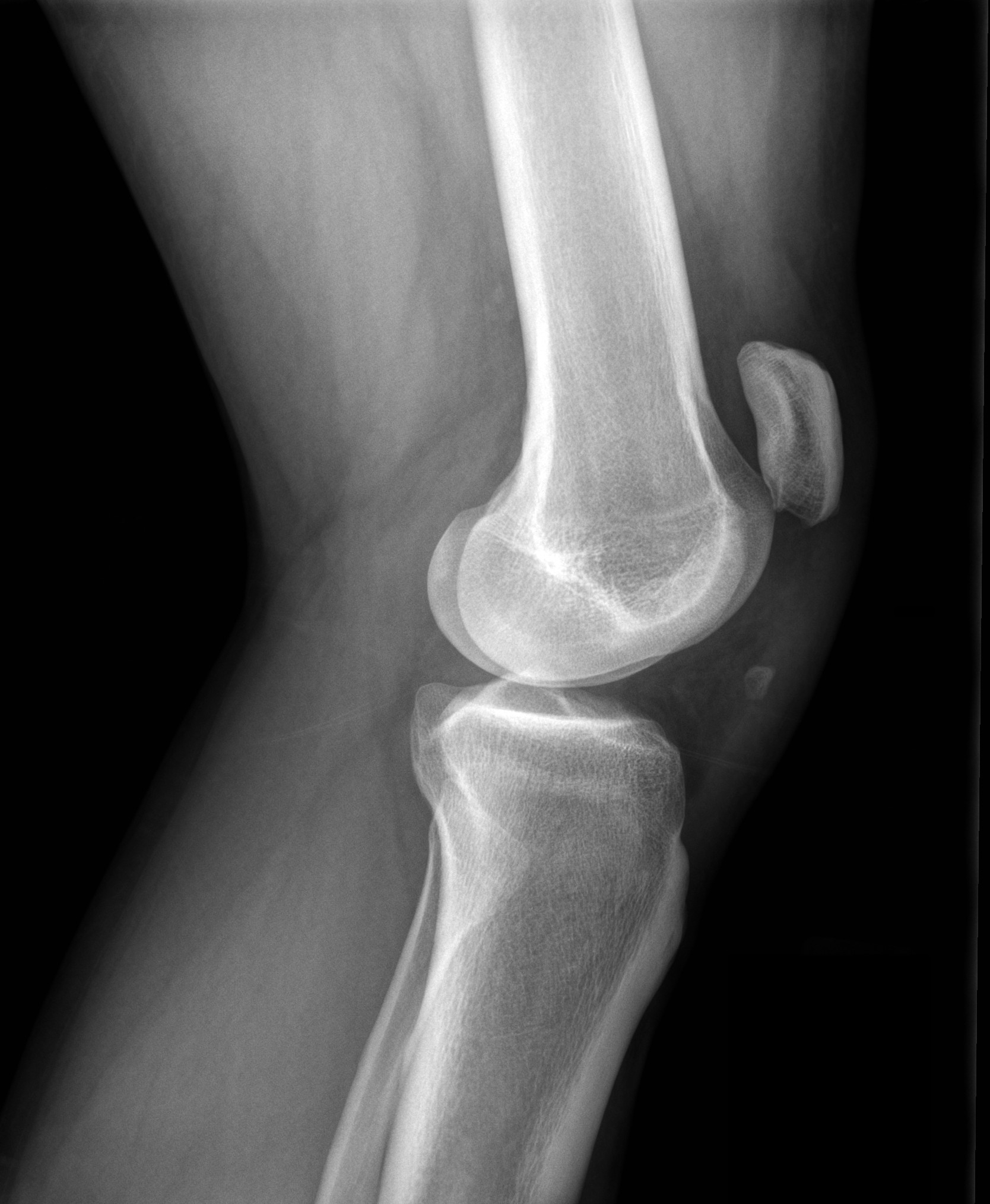 X-ray is shown. 